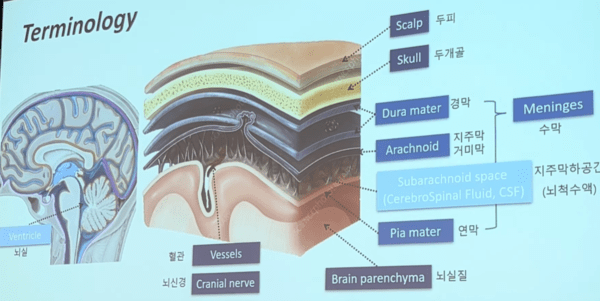 ▲뇌를 감싸는 3중 보호막: 두개골과 수막 구조 해부도”