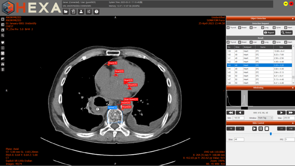 엑스큐브, 흉부 CT 기반 다장기 AI 진단보조 솔루션 'HEXA' 출시 - 뉴스 썸네일 이미지