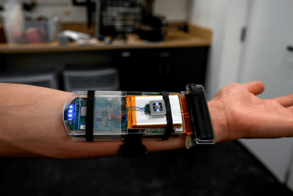 ▲손목 라이트닝 바카라 사이트의 내부. (사진=MIT 뉴스)